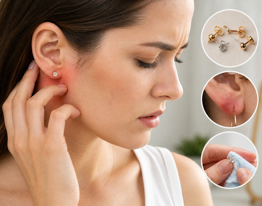 Why do earrings cause itching?
